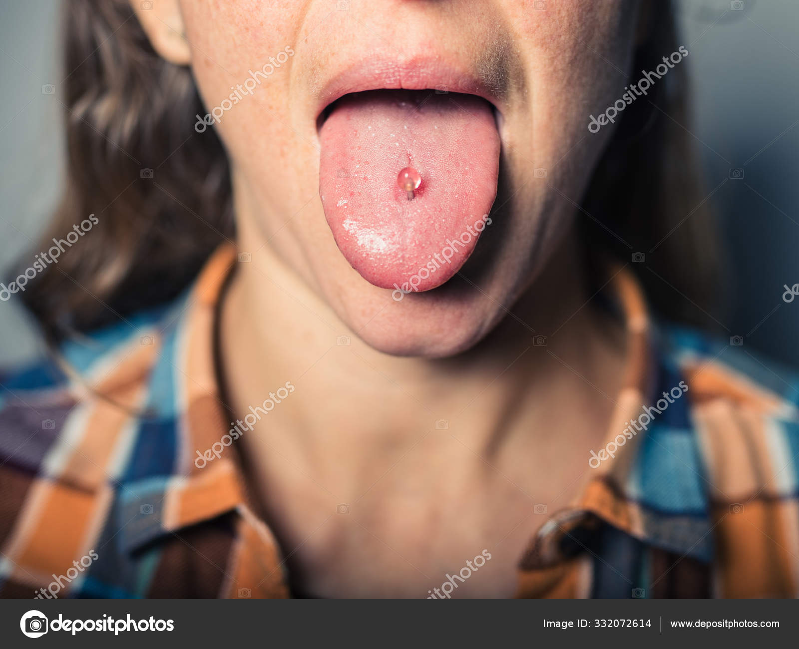 I've had my tongue web piercing for 5 months now and there are these little  white bumps on the end of each hole is this normal? - Quora