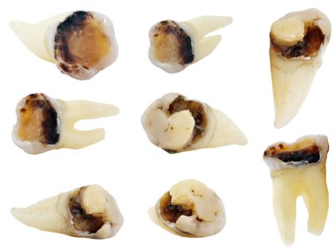 Beyaz arka planda izole edilmiş dişler, 8 nesne seti, yüksek çözünürlüklü.