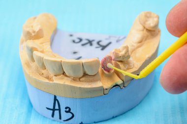 bir diş diş protez imalat teknisyeni bir diş laboratuvar elinde jaws modelleri alçı