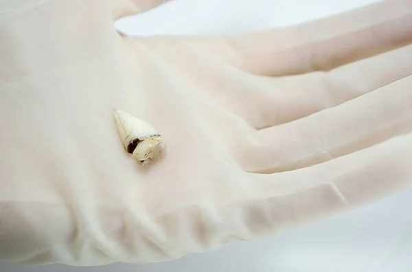 Extraktive Karieszähne Der Hand Eines Zahnarztchirurgen Auf Weißem Hintergrund Nahaufnahme — Stockfoto