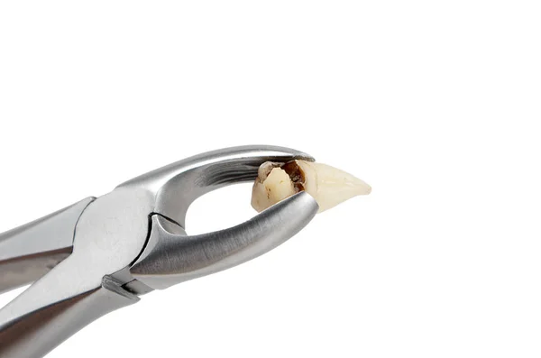 在手术钳中取出龋齿 在白色背景下近视 上智齿 被毁的牙齿充填 — 图库照片
