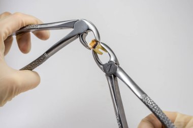 Caries büyük bir oyuk ile tahrip cerrahi forseps, azı dişi, yirmilik diş, diş çıkarma, diş cerrahisi, diş bakımı, diş bakımı