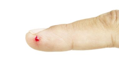 Dizin üzerinde bıçak yaraları Asya parmak. Taze yara