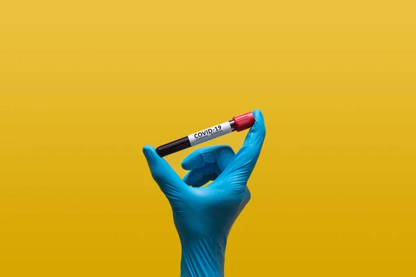 Handen Blå Gummihandske Håller Coronavirus Blodprov Provröret För Covid Analysera — Stockfoto