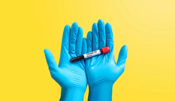在蓝色橡胶手套中的特写镜头手将考罗内韦尔斯血液样本放在试管中进行Covid 19分析 在黄色上分离 化验室分析 用于检测和发明治疗结肠病毒的药物和疫苗 — 图库照片