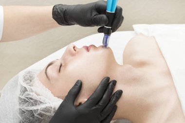 Güzellik salonundaki erkekler için kısmi mikro kaldırma prosedürü