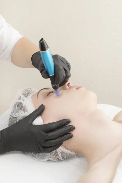 Fractional microneedle lifting procedure for men in a beauty salon