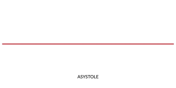 ECG Heartbeat Line. Electrocardiogram vector illustration. Asystole
