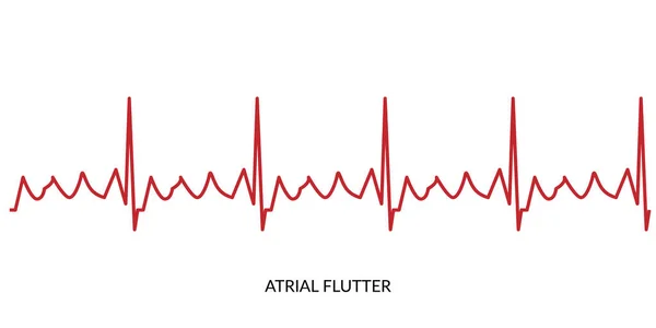 ECG Heartbeat Line. Illustration vectorielle d'électrocardiogramme. Lutte auriculaire — Image vectorielle