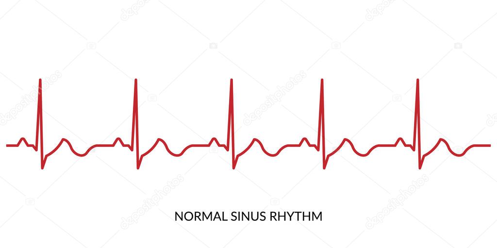 ECG Heartbeat Line. Electrocardiogram vector illustration. Normal Sinus Rhythm