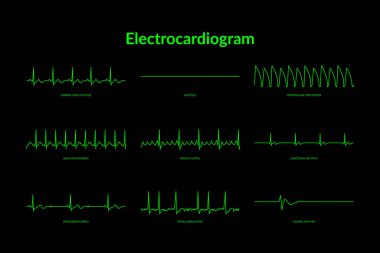 Elektrokardiyogram kalp atışı hattı monitörü. Vektör Eps10 İllüstrasyon