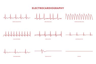 Elektrokardiyografi kalp atışı hattı monitörü. Vektör Eps10 İllüstrasyon