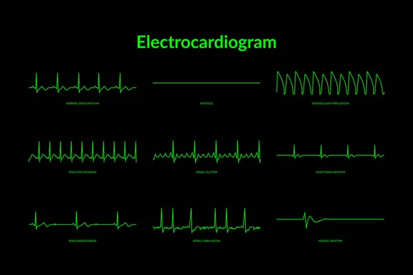 Electrocardiograma Monitor Línea Heartbeat Vector Eps10 Ilustración — Vector de stock