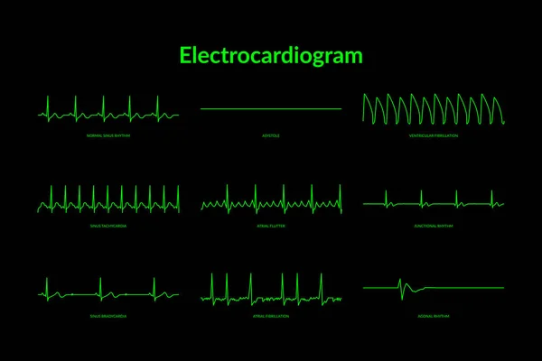 Elektrokardiyogram kalp atışı hattı monitörü. Vektör Eps10 İllüstrasyon
