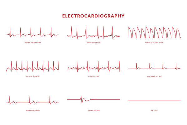 Electrocardiography Heartbeat Line monitor. vector EPS10 Illustration
