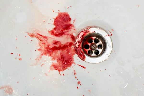Кровь в раковине у дантиста — стоковое фото