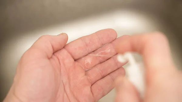 A man uses an antiseptic to disinfect hands