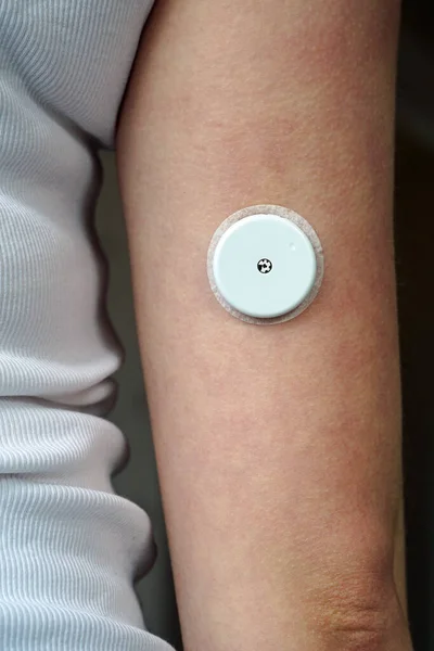 Bir Kola Bağlı Freestyle Libre Denilen Kan Şekeri Izleme Sensörü - Stok İmaj