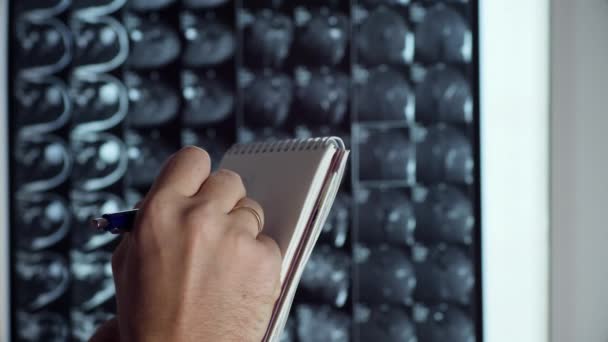 Medicul examinează scanarea RMN — Videoclip de stoc