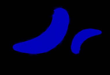 Çok bulaşıcı bir Coronavirüs virüsü, ağızdan bulaşma tehlikesi.