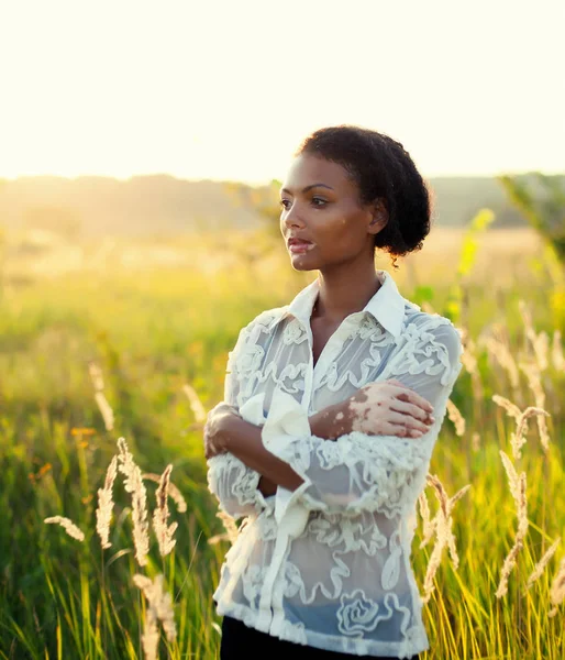 Schöne junge brünette Frau mit Vitiligo-Krankheit — Stockfoto