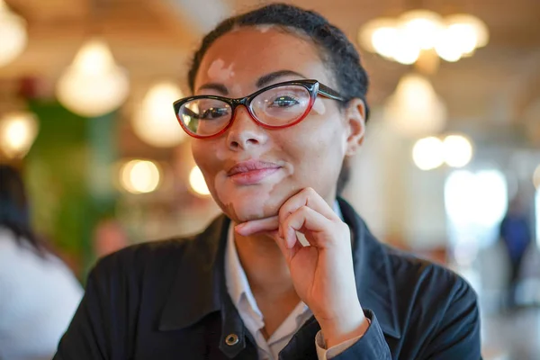 Een mooi jong meisje van Afrikaanse etniciteit met vitiligo zitten in een restaurant — Stockfoto