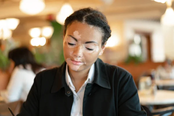 Vitiligo bir restoranda oturan Afrika kökenli güzel bir genç kız — Stok fotoğraf