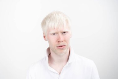 beyaz bir arka plan üzerinde izole t-shirt giyinmiş stüdyoda bir albino adam portresi. anormal sapmalar. sıradışı görünüm