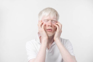 beyaz bir arka plan üzerinde izole t-shirt giyinmiş stüdyoda bir albino adam portresi. anormal sapmalar. sıradışı görünüm