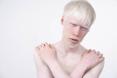 beyaz bir arka plan üzerinde izole t-shirt giyinmiş stüdyoda bir albino adam portresi. anormal sapmalar. sıradışı görünüm
