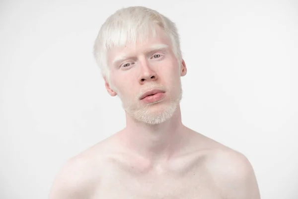 Portretul unui bărbat albinos în studio, îmbrăcat în tricou izolat pe un fundal alb. abateri anormale. aspect neobișnuit — Fotografie, imagine de stoc