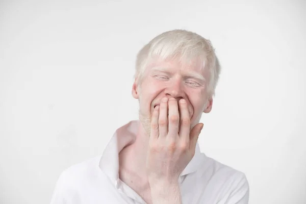 Retrato de um homem albino em estúdio vestido t-shirt isolado em um fundo branco. desvios anormais. aparência incomum — Fotografia de Stock