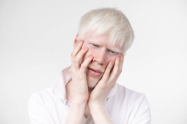 beyaz bir arka plan üzerinde izole t-shirt giyinmiş stüdyoda bir albino adam portresi. anormal sapmalar. alışılmadık bir görünüm. cilt anormalliği