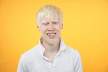 Mutlu gülümseyen albino adam beyaz tenli saç stüdyosu tişört giymiş sarı arka plan anormallikleri alışılmadık görünüş anormalliği güzel insanlar  