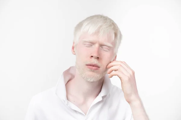 Portrait Albino Man Studio Dressed Shirt Isolated White Background Abnormal — Stock Photo, Image