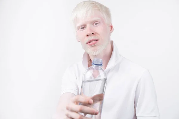 Portrait Albino Man Studio Dressed Shirt Isolated White Background Abnormal — Stock Photo, Image
