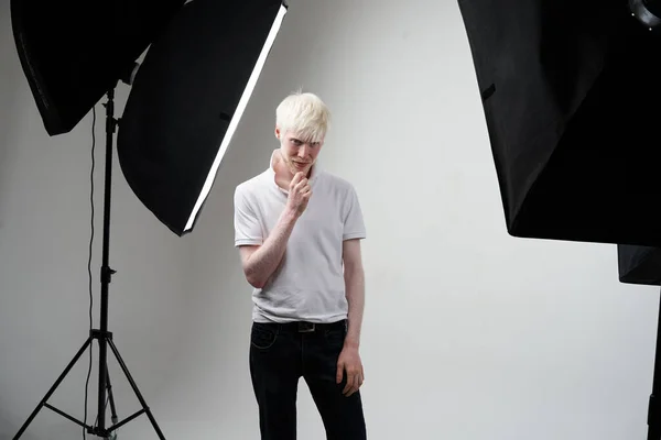 Serieux Albinos Homme Peau Blanche Studio Cheveux Habillé Shirt Debout — Photo