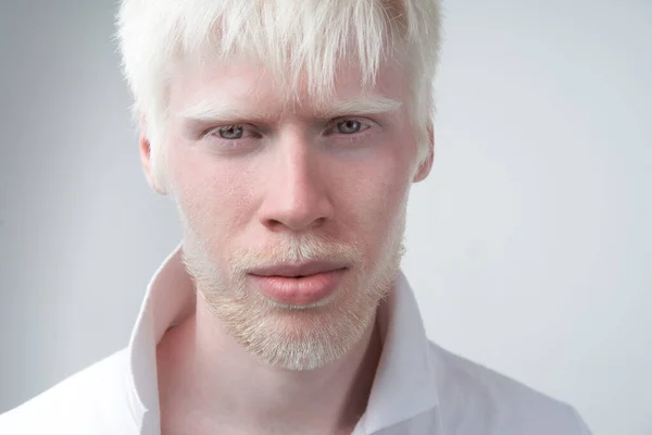 Λυπηρό Albino Άνθρωπος Λευκό Δέρμα Στούντιο Μαλλιά Ντυμένος Shirt Απομονωμένο — Φωτογραφία Αρχείου