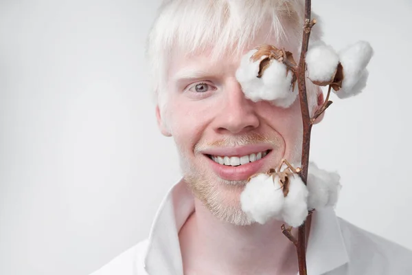 Feliz Sorriso Albino Homem Branco Pele Cabelo Macio Macio Algodão — Fotografia de Stock