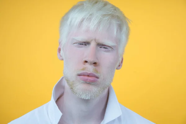 可悲的白化病男子白色皮肤头发工作室穿着T恤孤立的黄色背景 不正常的偏差不寻常的外表有特殊外表的漂亮人 — 图库照片