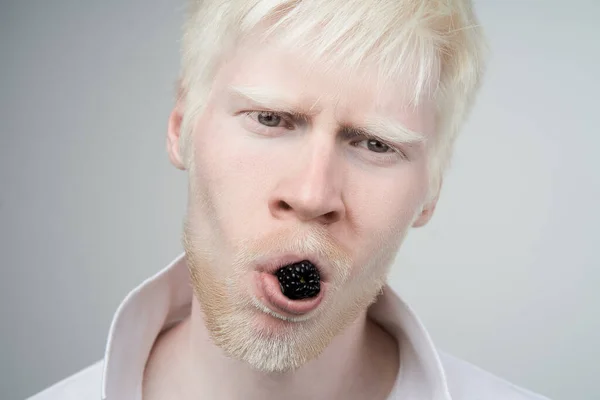 Feliz Albino Homem Branco Pele Cabelo Estúdio Vestido Shirt Isolado — Fotografia de Stock