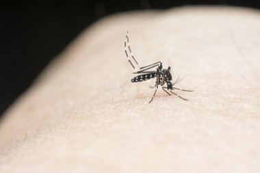 Sivrisinek insan vücudundan kan emiyor.