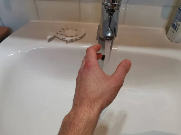 Hygiëne concept. Wassen van één hand met water — Stockfoto