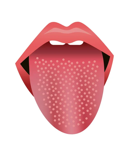 Symptômes de scarlatine dans la langue de l'homme. Illustration vectorielle . — Image vectorielle