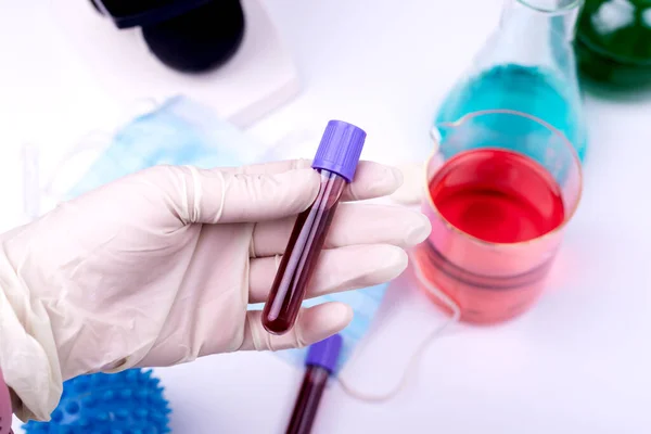 Lidská Ruka Drží Krevní Testy Laboratoři Coronavirus 2019 Ncov Koncept — Stock fotografie