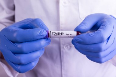 Doktor kan testini elinde tutuyor. Coronavirus 2019-nCoV konsepti hala kan testi ile yaşam. COVID-19 salgın geçmişi.