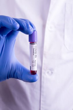 Doktor kan testini elinde tutuyor. Coronavirus 2019-nCoV konsepti hala kan testi ile yaşam. COVID-19 salgın geçmişi.