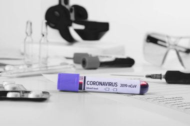 Kan testi labaratuvarda yapılır. Coronavirus 2019-nCoV konsepti hala kan testi ve ilaçlarla yaşam. COVID-19 arkaplanı.