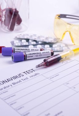 Kan testi labaratuvarda yapılır. Coronavirus 2019-nCoV konsepti hala kan testi ve ilaçlarla yaşam. COVID-19 arkaplanı.