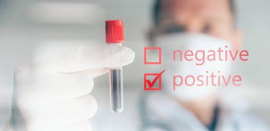 Doktorun Covid-19 testi pozitif çıktı. Coronavius salgını krizi. Laboratuvarda bir tüpte kan örneği.. 